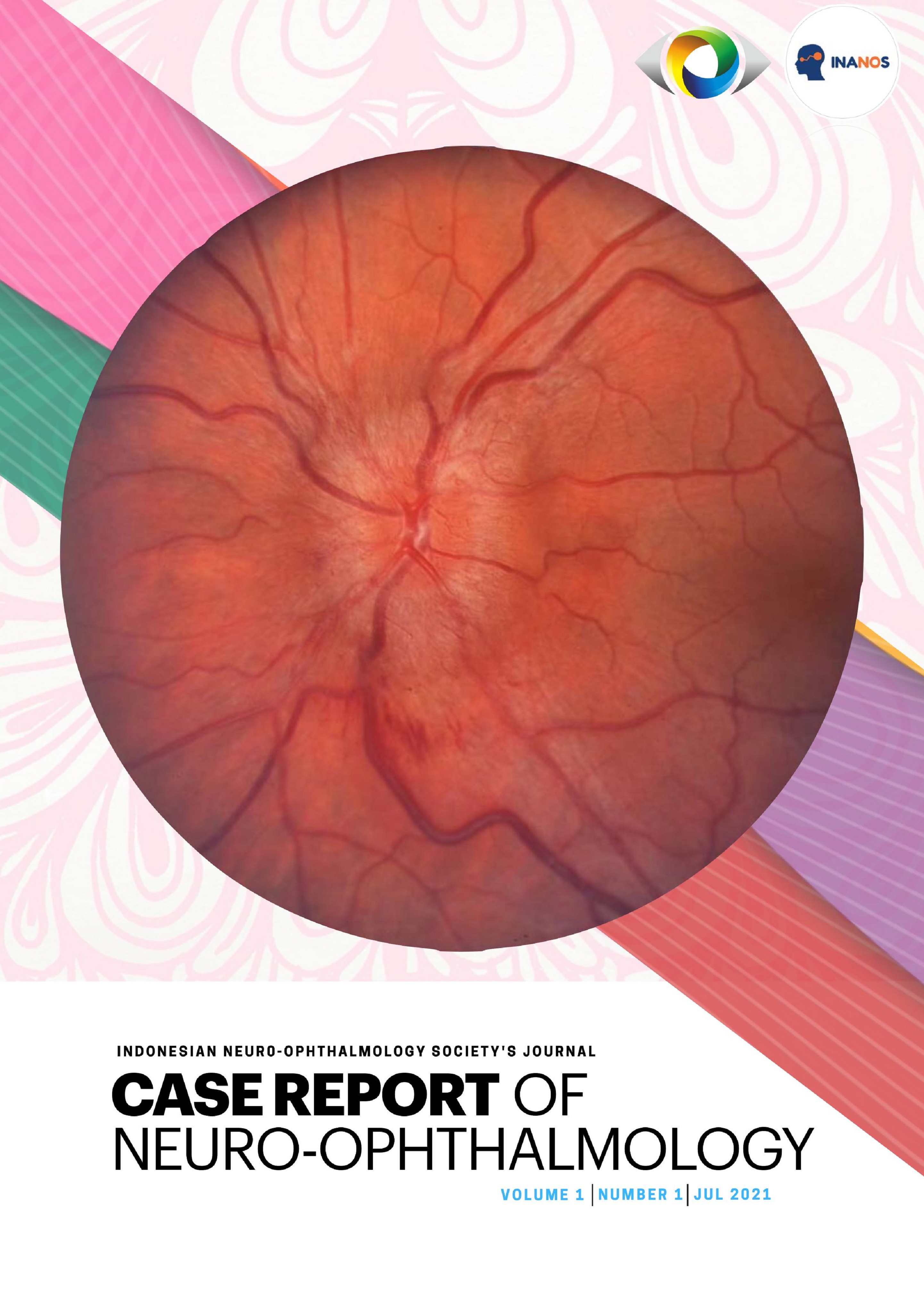 Case Report Of Neuro Ophthalmology Journal